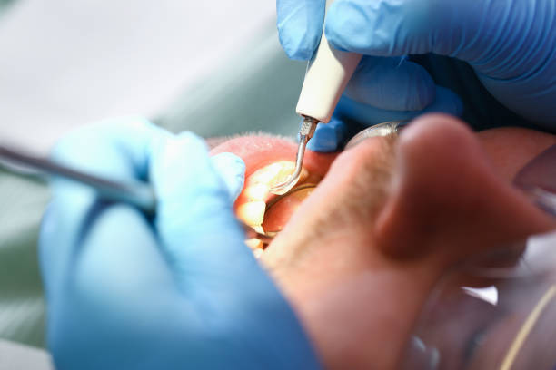 Best Urgent Tooth Repair  in Smyrna, GA